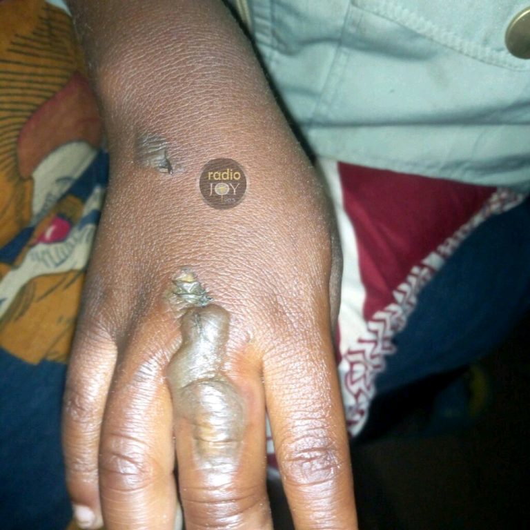 KIGOMA: MTOTO ACHOMWA MOTO MIKONO NA MAMA YAKE KISA MUWA